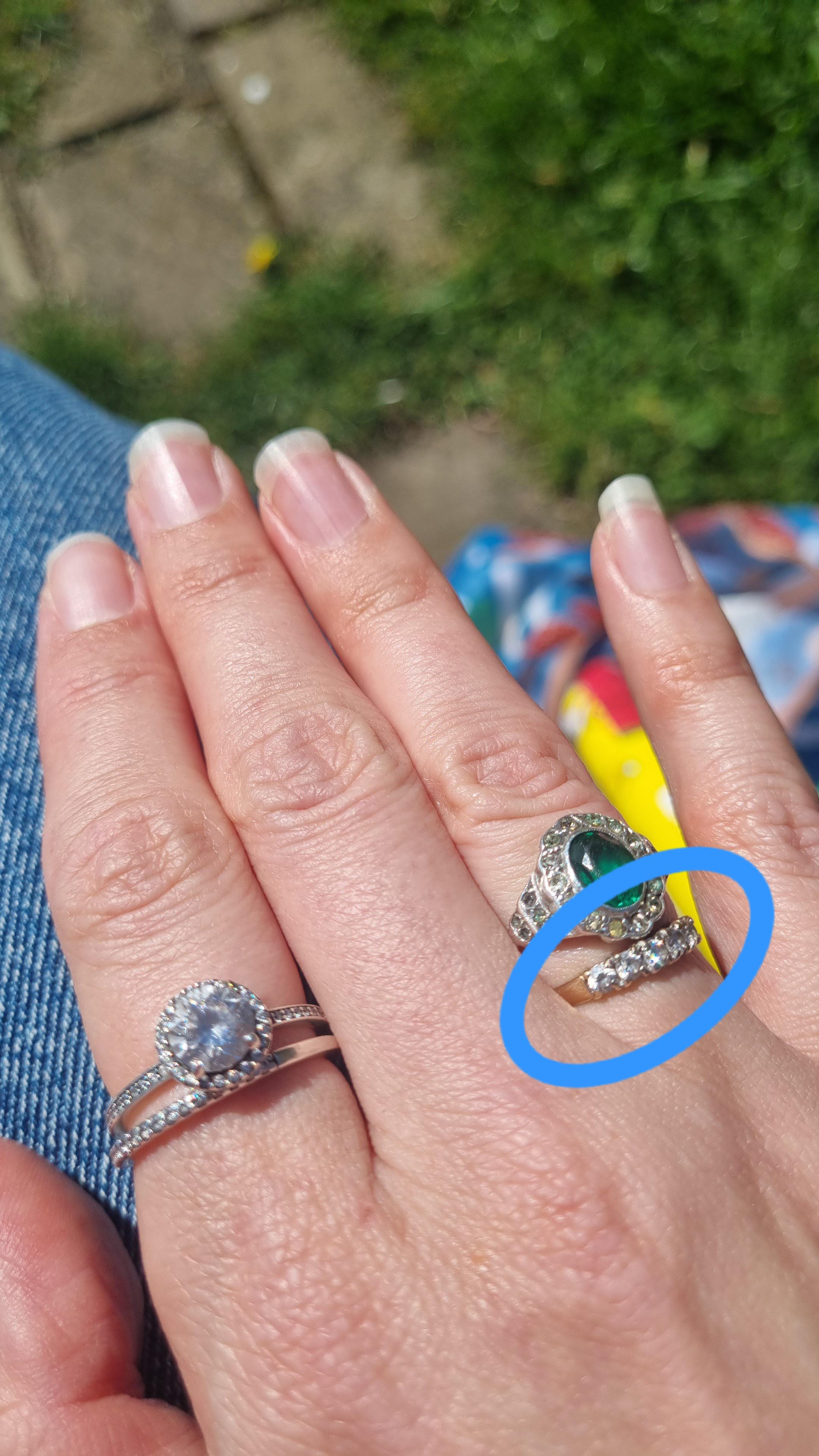Lost ring