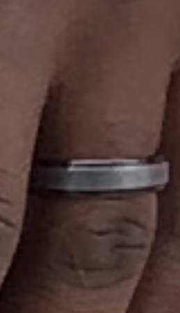 Lost ring