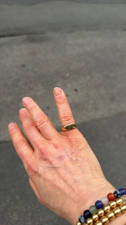 Lost Ring in Silver Spring