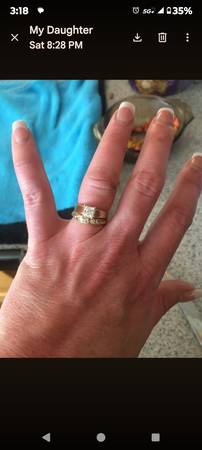 Lost ring