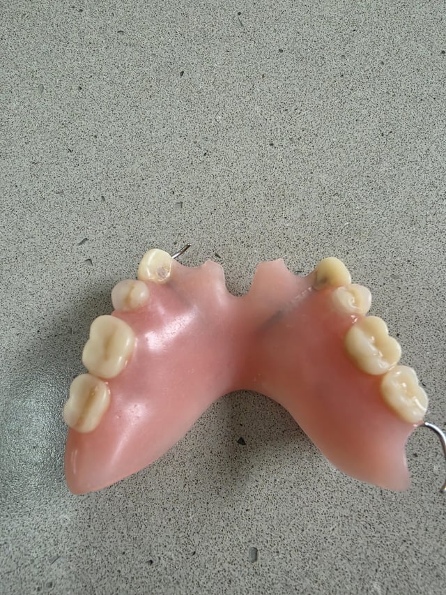 Found Denture in Wellington