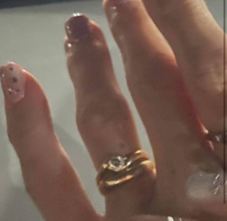 Lost ring