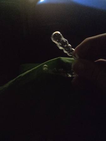 Lost Dental Aligners in San Francisco