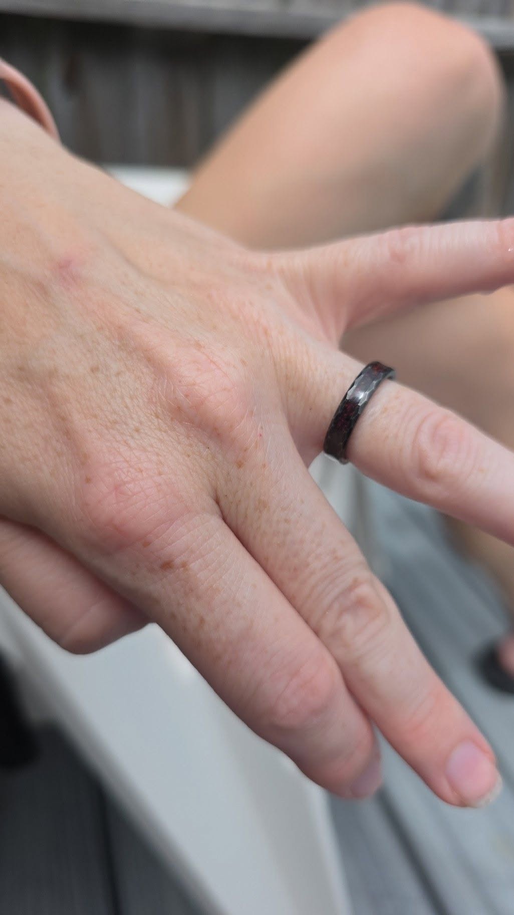 Lost ring