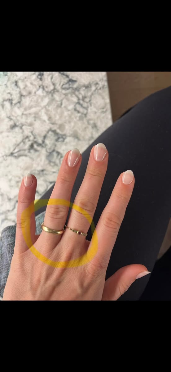 Lost Ring in Vancouver