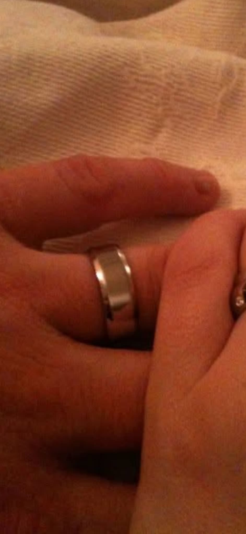 Lost ring