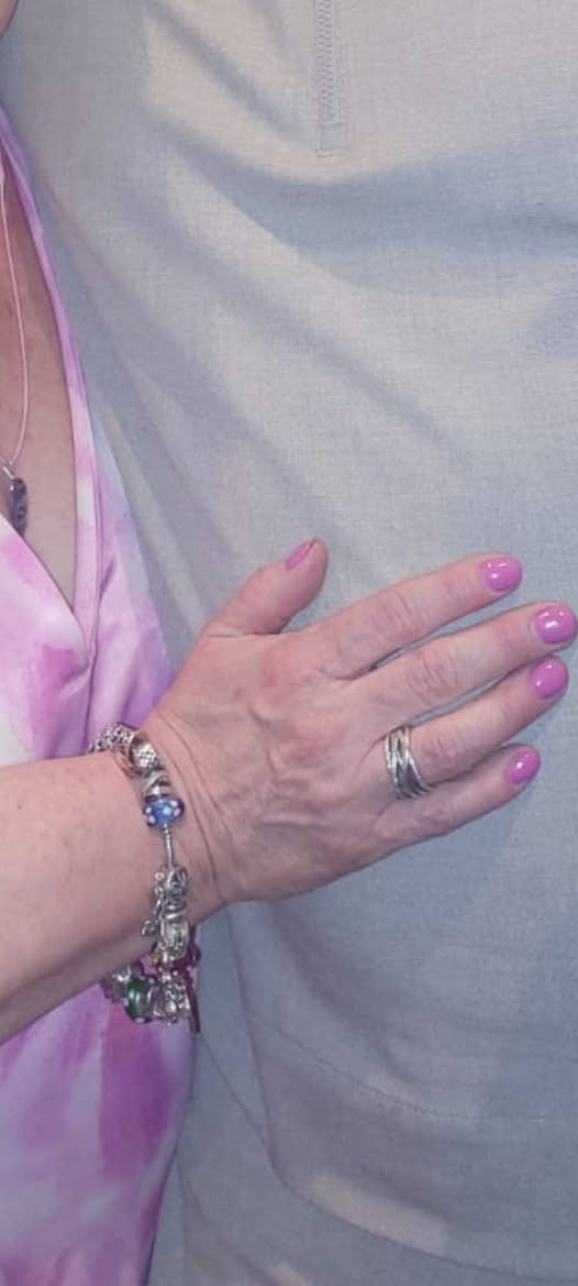 Lost Bracelet in Dublin