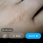 Lost ring